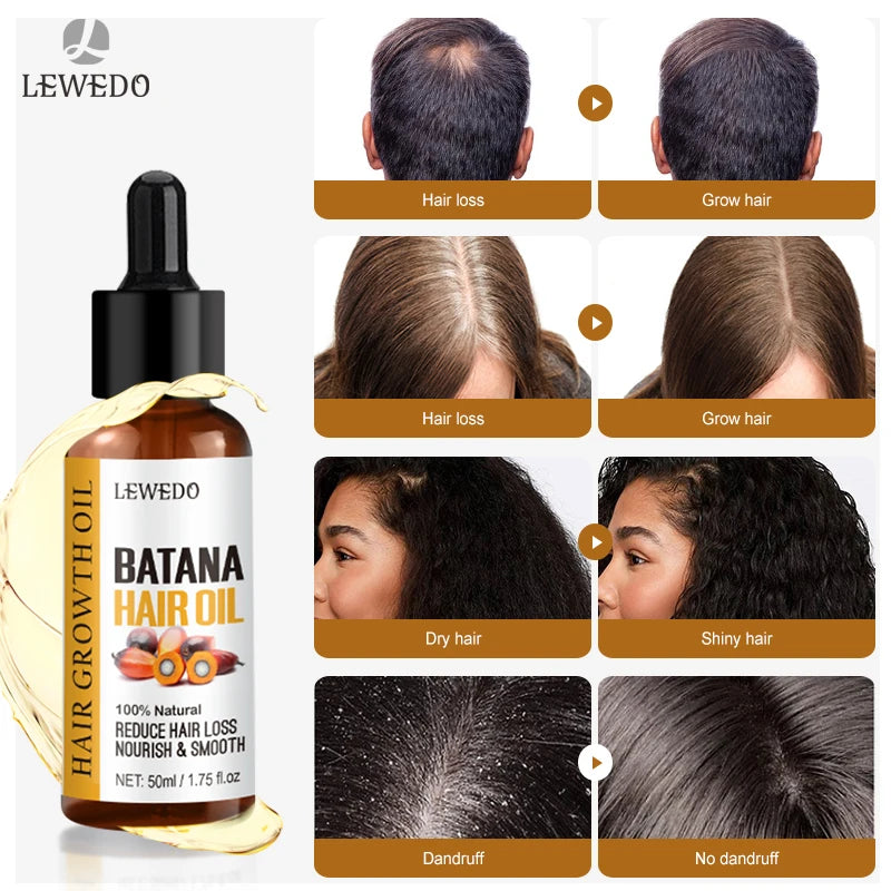 Raw Batana Hair Restoration Serum