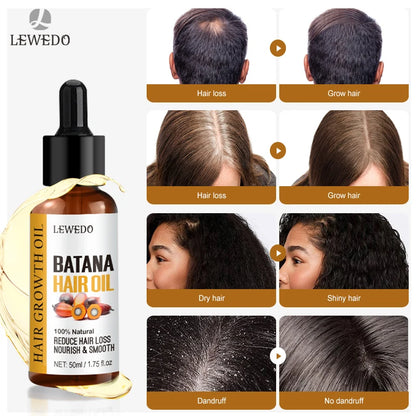 Raw Batana Hair Restoration Serum